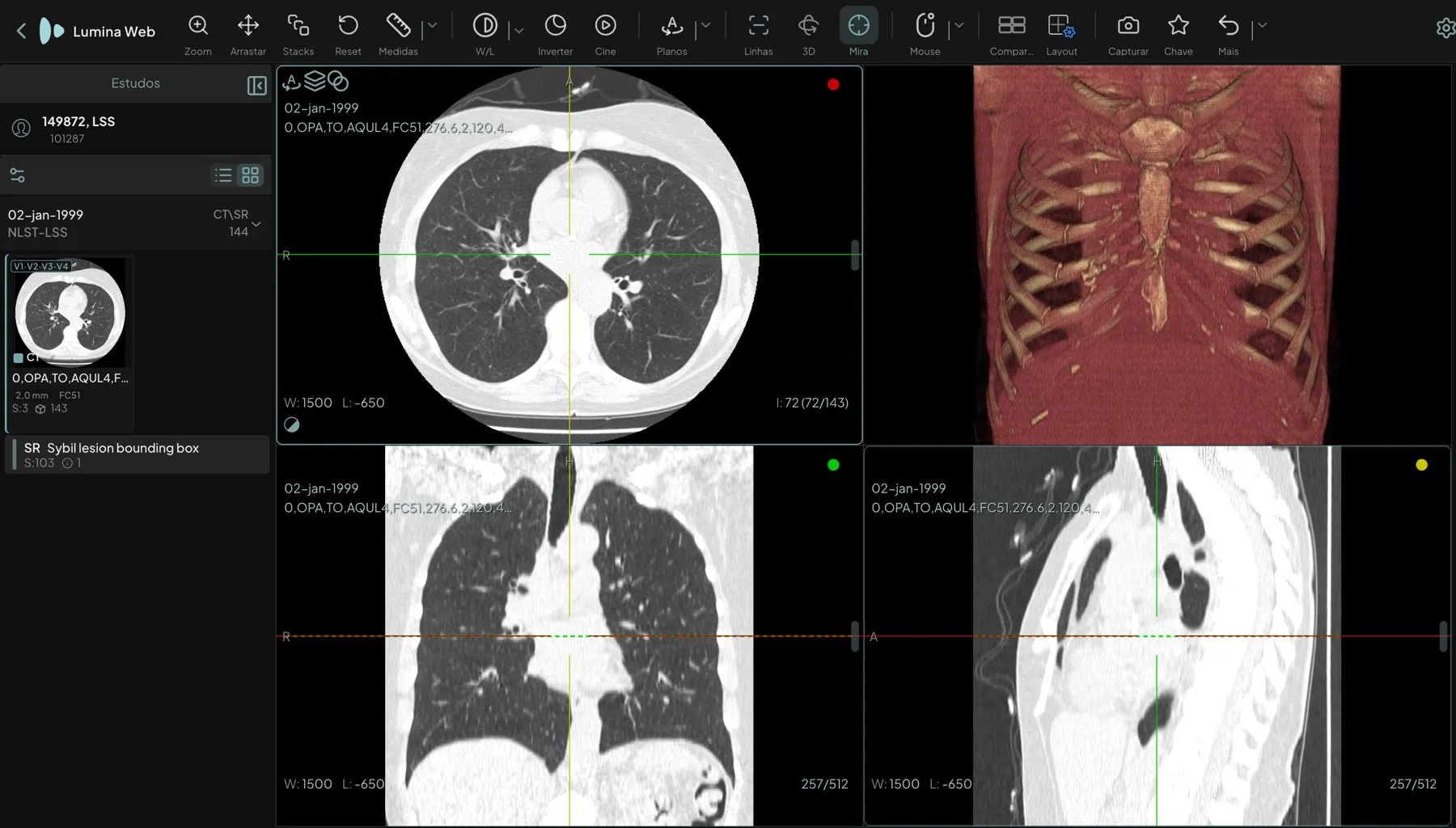 Lumina Web com uma tomografia de tórax em três planos e o volume renderizado em 3D, aberta no navegador, em base de demonstração com dados fictícios