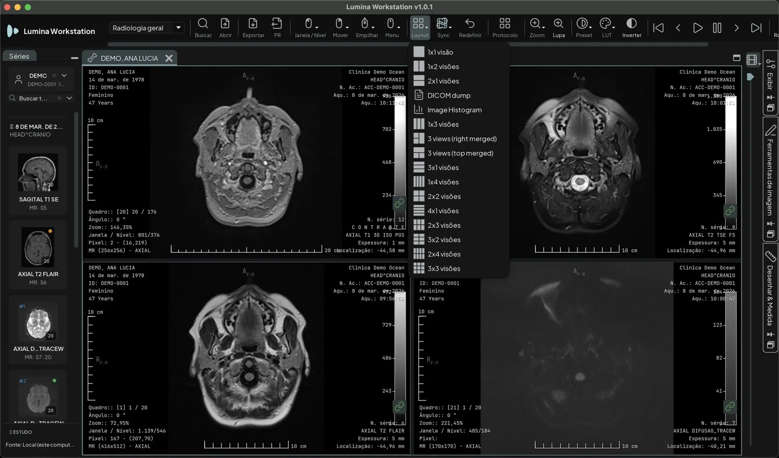 Menu Layout da barra com as grades de vistas disponíveis