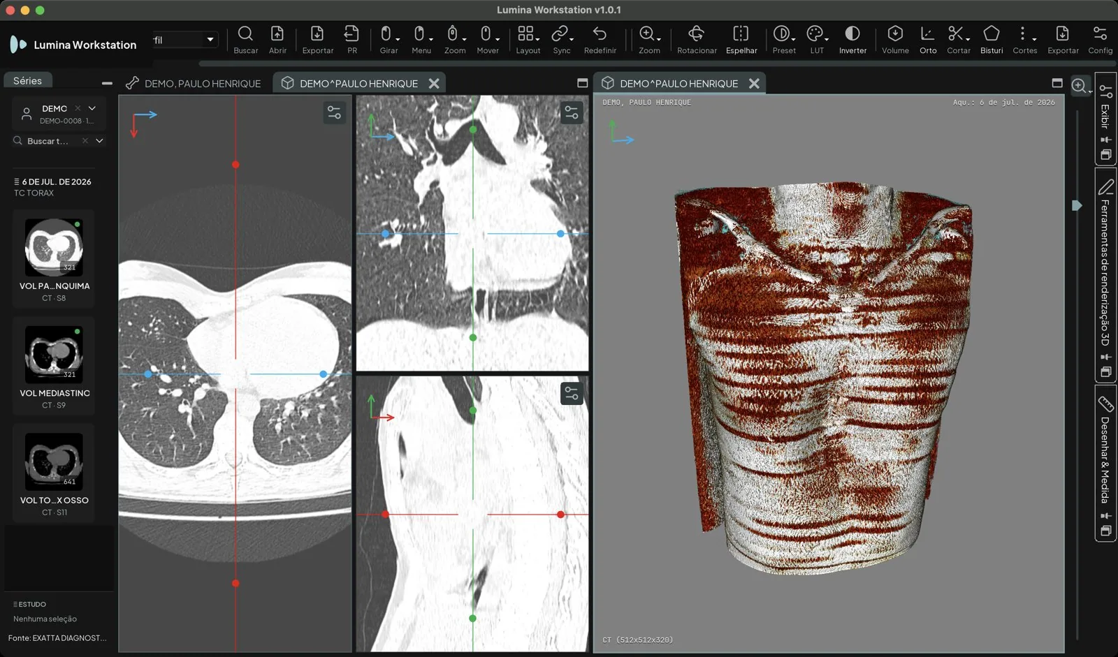 Lumina Workstation no macOS com a TC de tórax em três planos à esquerda e a reconstrução 3D à direita, com a barra do 3D: Volume, Orto, Cortar, Bisturi e Cortes